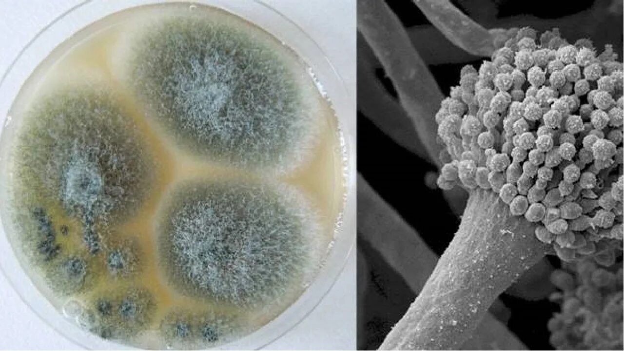 Аспергилла грибок. Плесневые грибы аспергилл. Черная гниль (Aspergillus fumigatus).. Грибок аспергиллус.