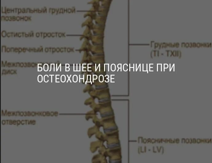 Грудные позвонки боль. Остеохондроз шейного отдела грудного отдела и поясничного отдела. Болит шейно грудной отдел позвоночника. Остеохондроз шейного отдела армия.