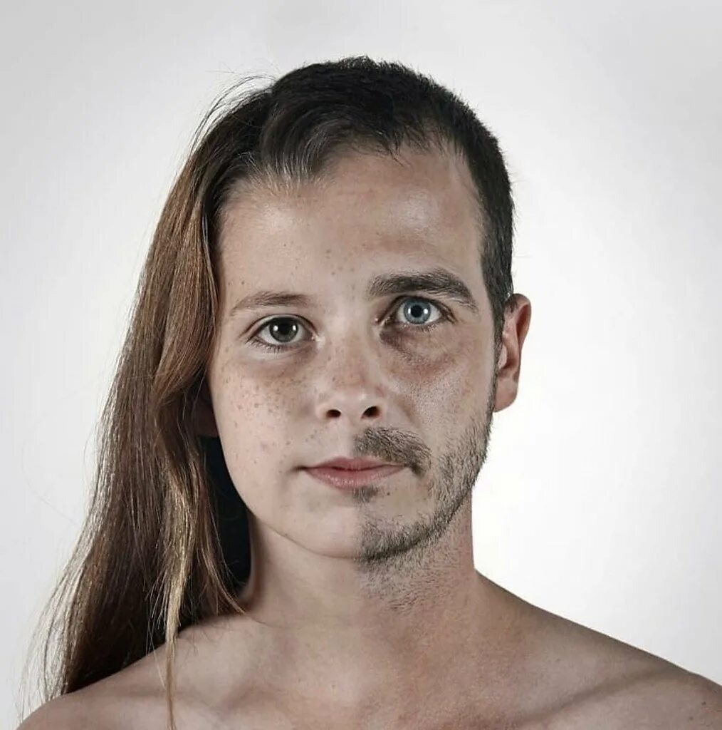 Ульрик Коллетт. Ульрик Коллет генетические портреты. Лицо человека. Люди с необычной внешностью.