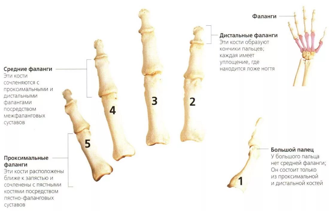 Фаланги пальца тип соединения. Проксимальная фаланга мизинца кисти. Проксимальная фаланга 1 пальца кисти. Перелом проксимальной фаланги 1 пальца. Кости пальцев фаланги анатомия.