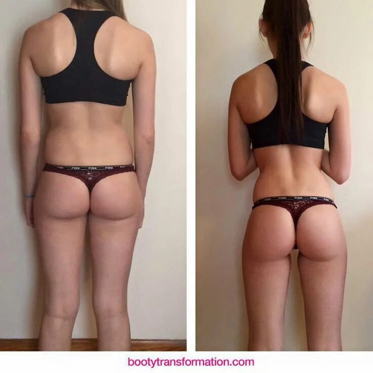 Одна ягодица больше другой. Плоские ягодицы. Галифе на бедрах. Худые ягодицы. Скинни фэт.