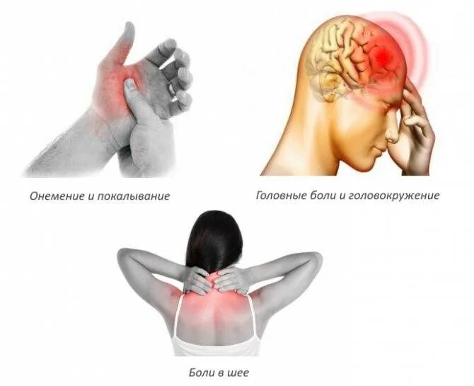 Шейный остеохондроз симптомы. Симптоматика шейного остеохондроза. Остеохондроз шеи симптомы. Онемевает правая сторона лица