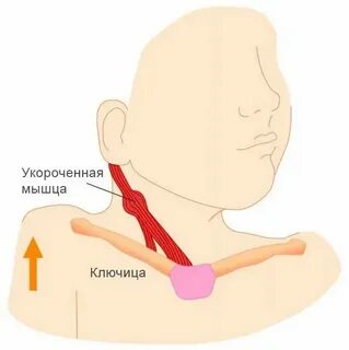 Ребенок кривит лицо