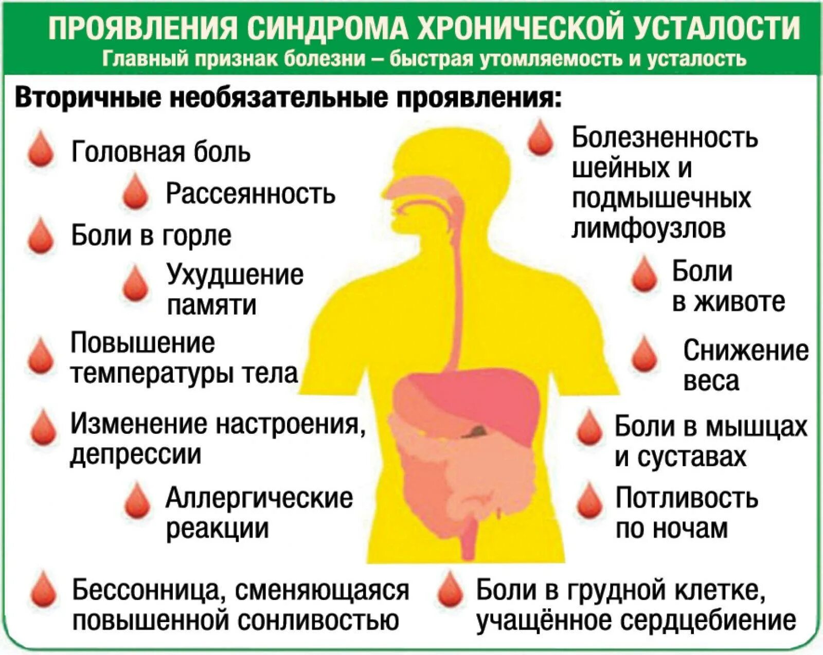 Признаки недомогания. Синдом хронической усталости. Хроническая усталость симптомы. Проявление синдрома хронической усталости. Синдром хронической усталости симптомы у женщин.