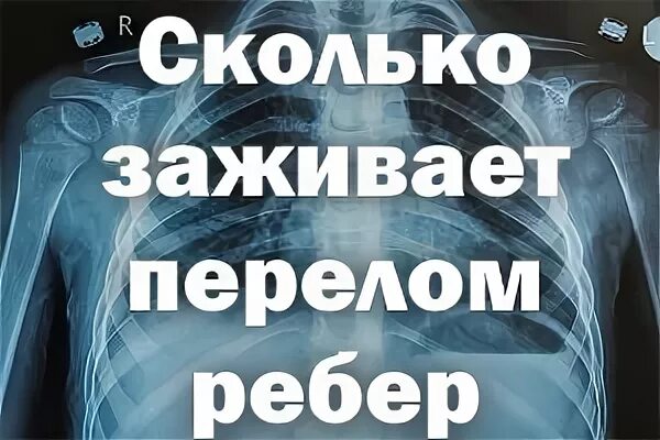 Перелом ребра сколько заживает. Перелом ребра сроки заживления. Больничный лист перелом ребра. Как долго заживают сломанные ребра.