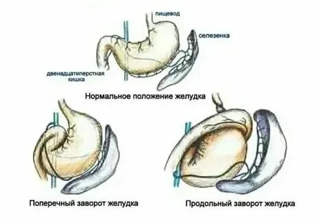 Почему нельзя обезболивать живот