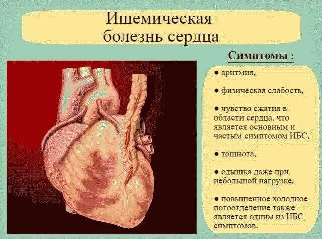 Ибс симптомы и лечение у женщин. Ишемия болезнь сердца причины. симптоматика ишемической болезни сердца. ишемическая болезнь сердца (ибс). ишемическая болезнь симптомы.