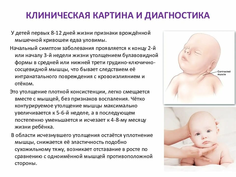 Почему ребенок крутит головой из стороны