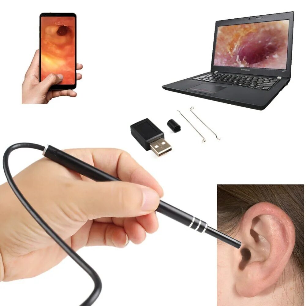Видеокамера на ухо. Ухочистка xiaomi. Камера ушки. Камера ушки. Камера ушки.