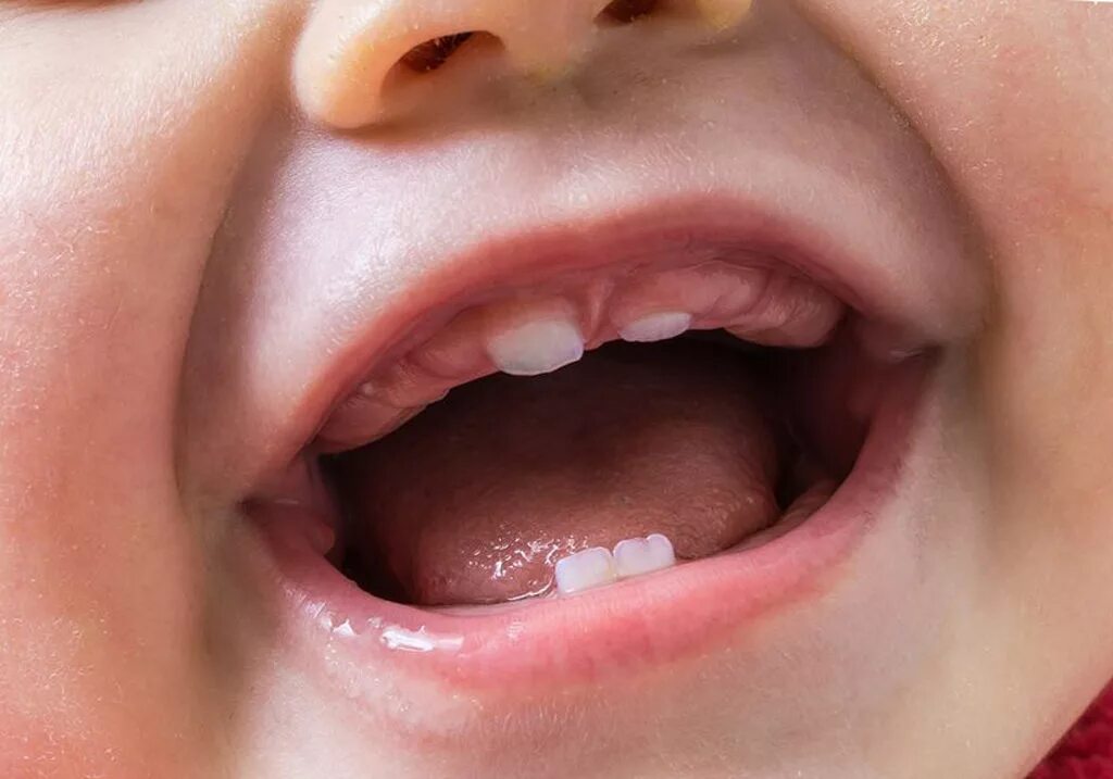 Сколько прорезывается зуб у ребенка. Прорезывание зубов у младенцев. Прорезывание нижних зубов у детей.