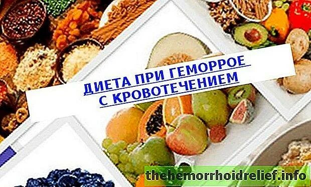 Продукты питания при геморрое. Диета при геморрое. Геморрой питание диета. Разрешенные продукты при геморрое. Что кушать после операции на геморрой