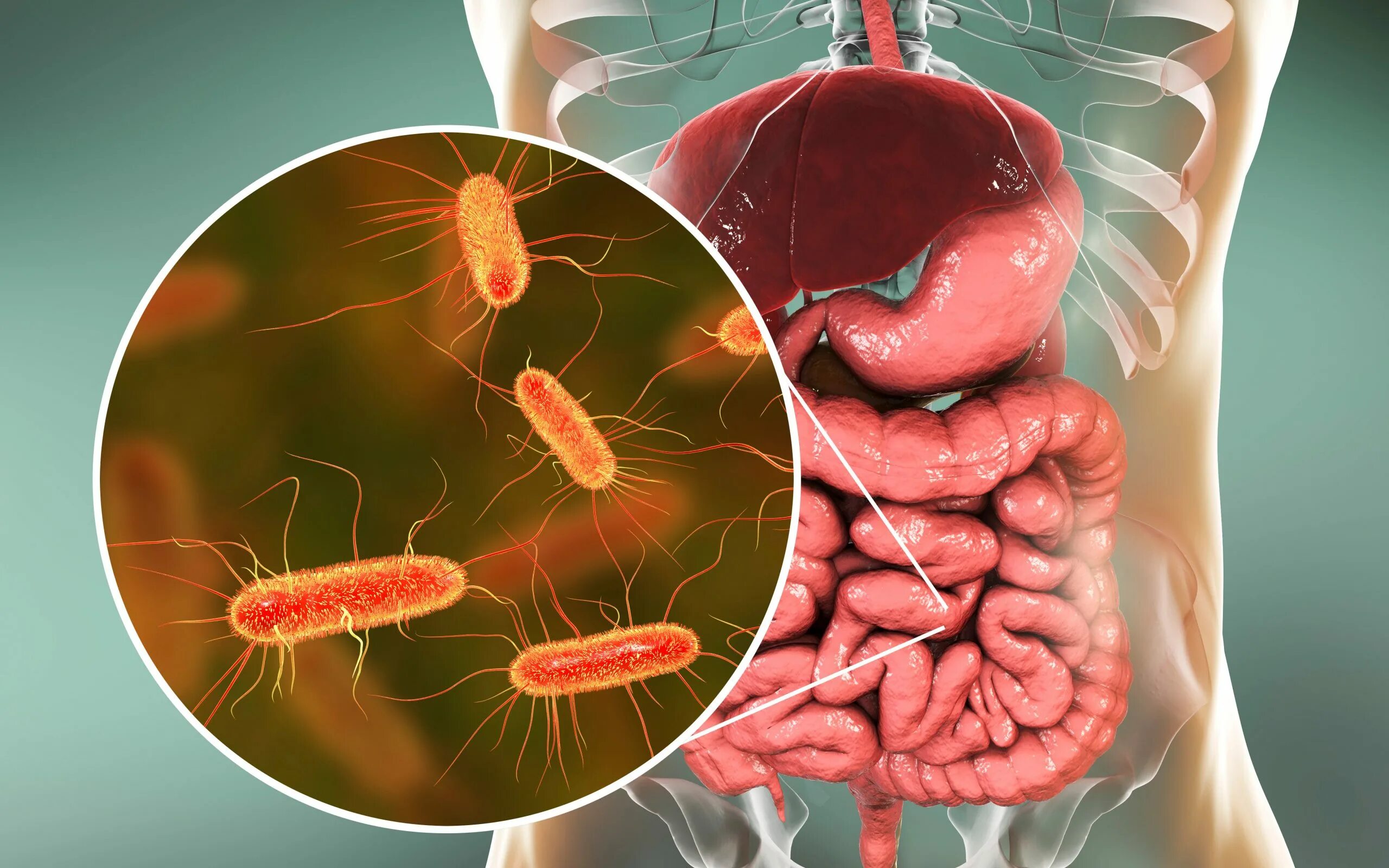 Иерсиниоз и псевдотуберкулез. Escherichia coli микробиота. Иерсиниоз возбудитель. Бактерия Escherichia coli. Брюшной грипп