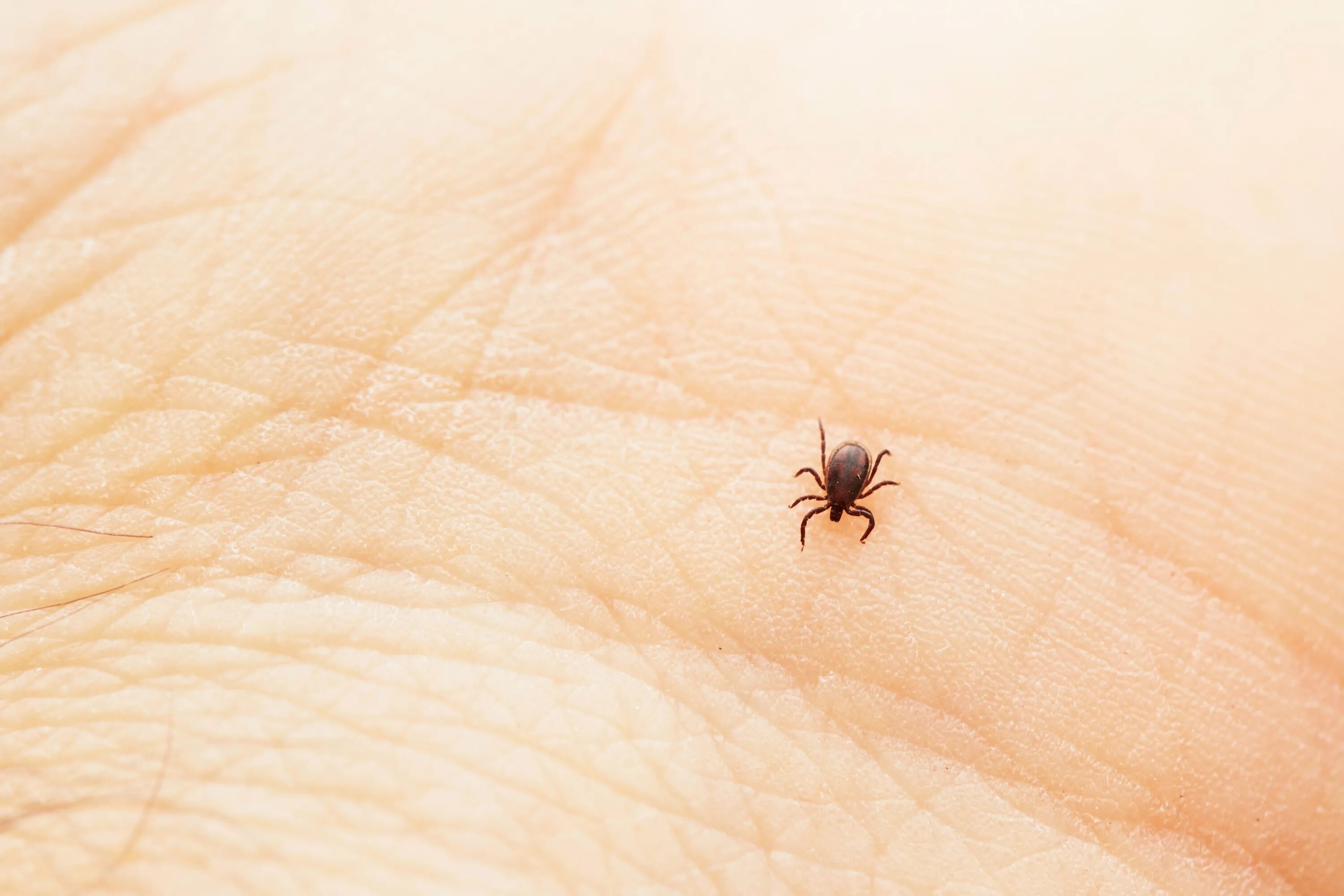 Собачий клещ ixodes ricinus. Клещевой энцефалит укус клеща. Baby ticks. Укус боррелиозного клеща. Клещ amblyomma variegatum.
