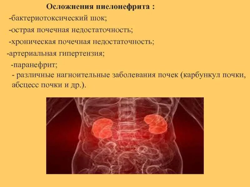 Вторичный пиелонефрит у детей. Осложнения хронического пиелонефрита, клинические проявления.. Осложнения при остром пиелонефрите. Последствия острого пиелонефрита. Осложнением хронического пиелонефрита является.