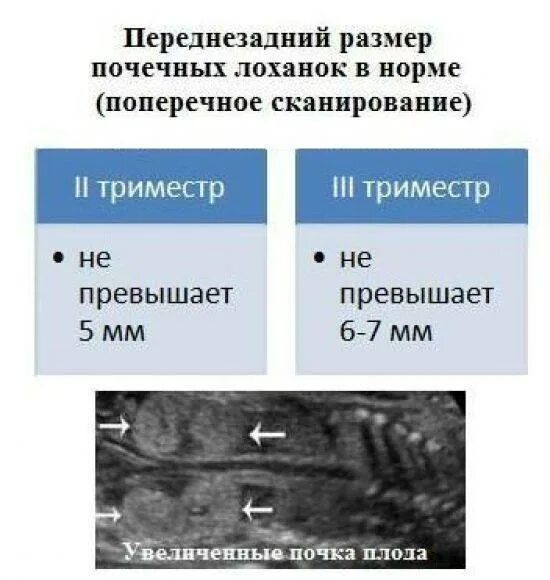 Нормы лоханок почек плода