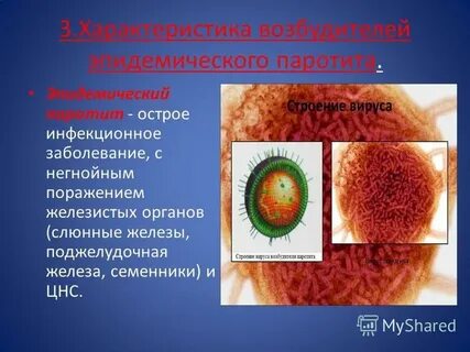 Возбудитель паротита