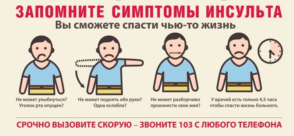 Как понять что был микроинсульт