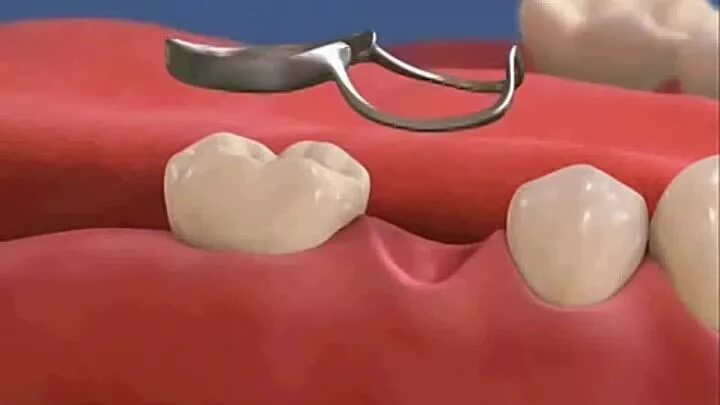 держатель места для молочных