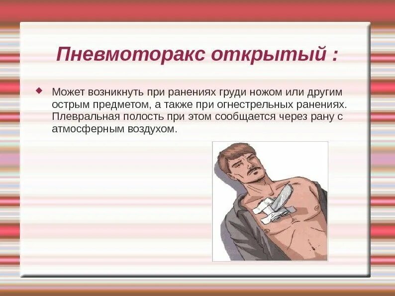 Помощь при открытом пневмотораксе тест