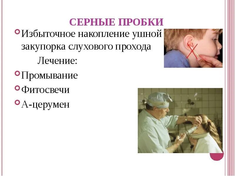 Как образуется серная пробка. Презентация серная пробка. закупорка слухового прохода. аспирация серной пробки.