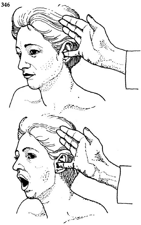 методика пальпации внчс. пальпация сустава внчс. пальпация внчс в стоматологии. обследование внчс пальпация. пальпация височно-нижнечелюстного сустава.