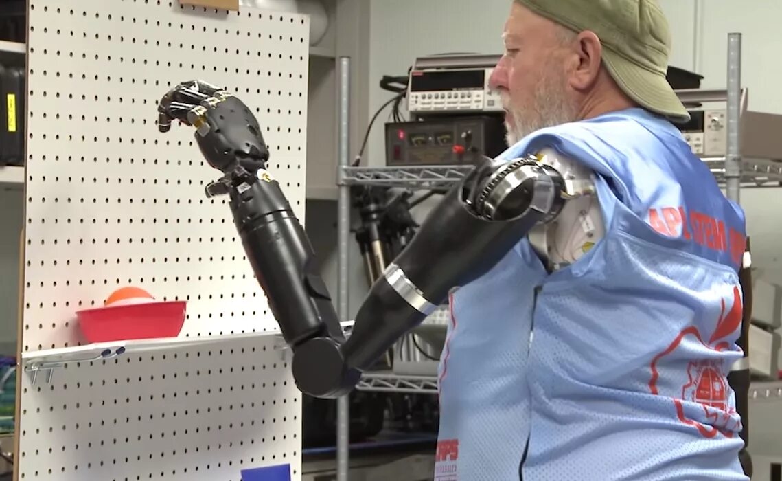 Бионические протезы, управляемые силой мысли. Джесси Салливан бионические протезы. Протез руки. Бионический протез управляемый мозгом.