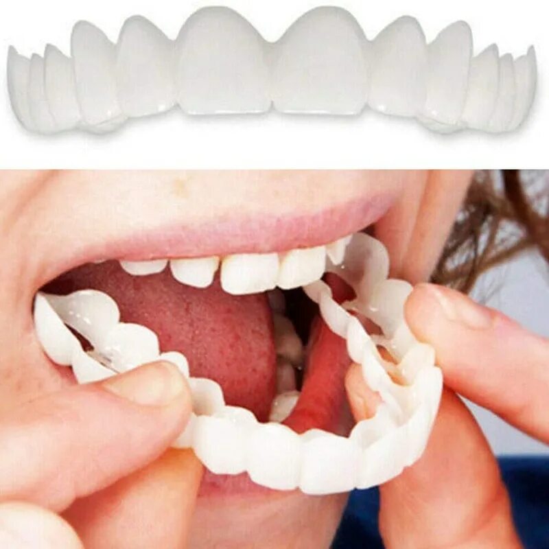 Как ставятся виниры на зубы. Виниры для зубов snapon smile (белый). накладные зубы snap on smile. съемные виниры snap-on smile.