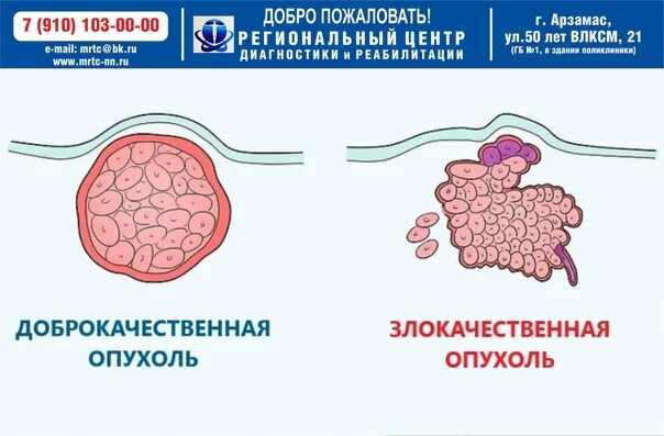 Доброкачественное или злокачественное новообразование. Доброкачественное или злокачественное новообразование. Критерии отличия доброкачественных и злокачественных опухолей. Классификация доброкачественных опухолей. Доброкачественные и злокачественные опухоли.
