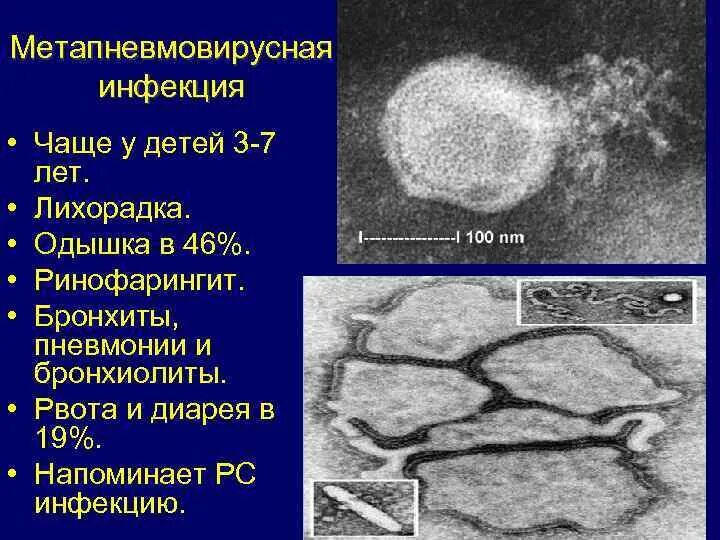 Метапневмовирус у ребенка. Метапневмовирусная инфекция. Метапневмовирус возбудитель. Метапневмовирусная. Метапневмовирусная инфекция этиология.