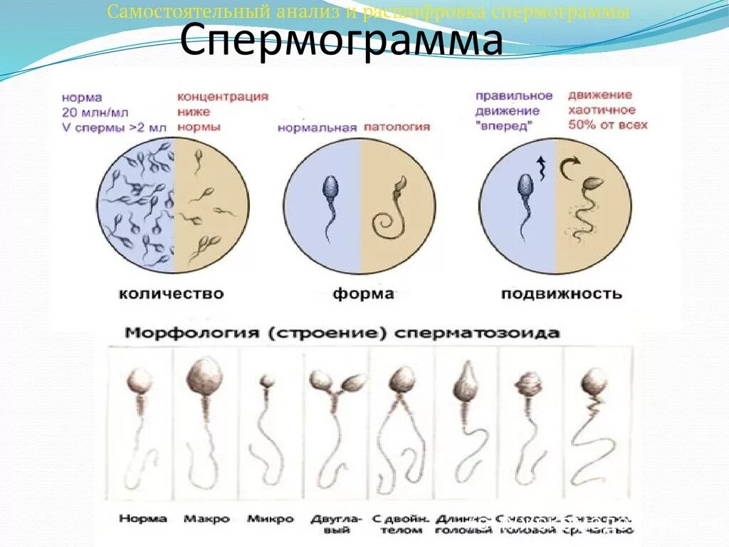 Виды почу. Астенозооспермия показатели спермограммы. Агглютинация спермограмма. Нормальные сперматозоиды. Патология сперматозоидов.