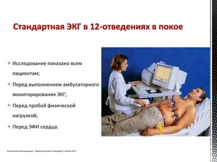 Сколько по времени длится экг