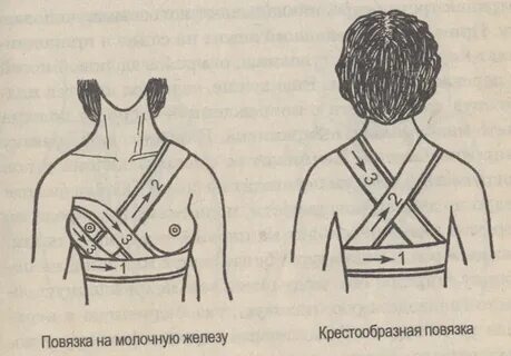 Повязка на молочные железы