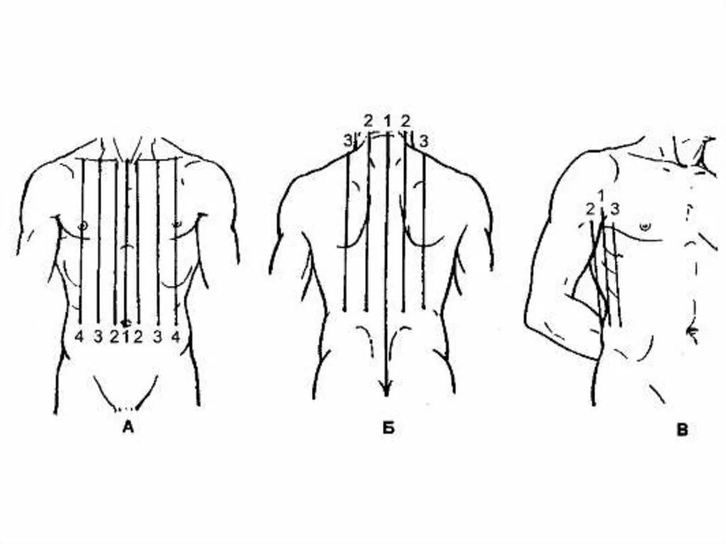 Вертикальные линии соединяющие. Клиническая топография грудной клетки. Топографические линии грудной клетки. Топография линии грудной клетки. Условные вертикальные линии грудной клетки.