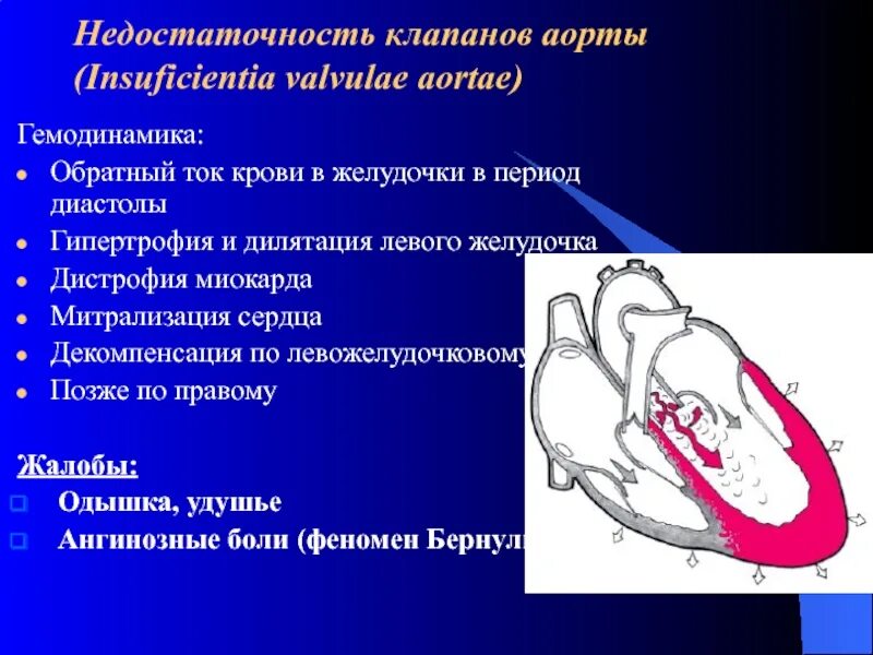 Митральный стеноз признаки. Порок аортального клапана сердца. Аортальная недостаточность гемодинамика схема. Недостаточность клапана аорты гемодинамика. Недостаточность полулунного клапана аорты.