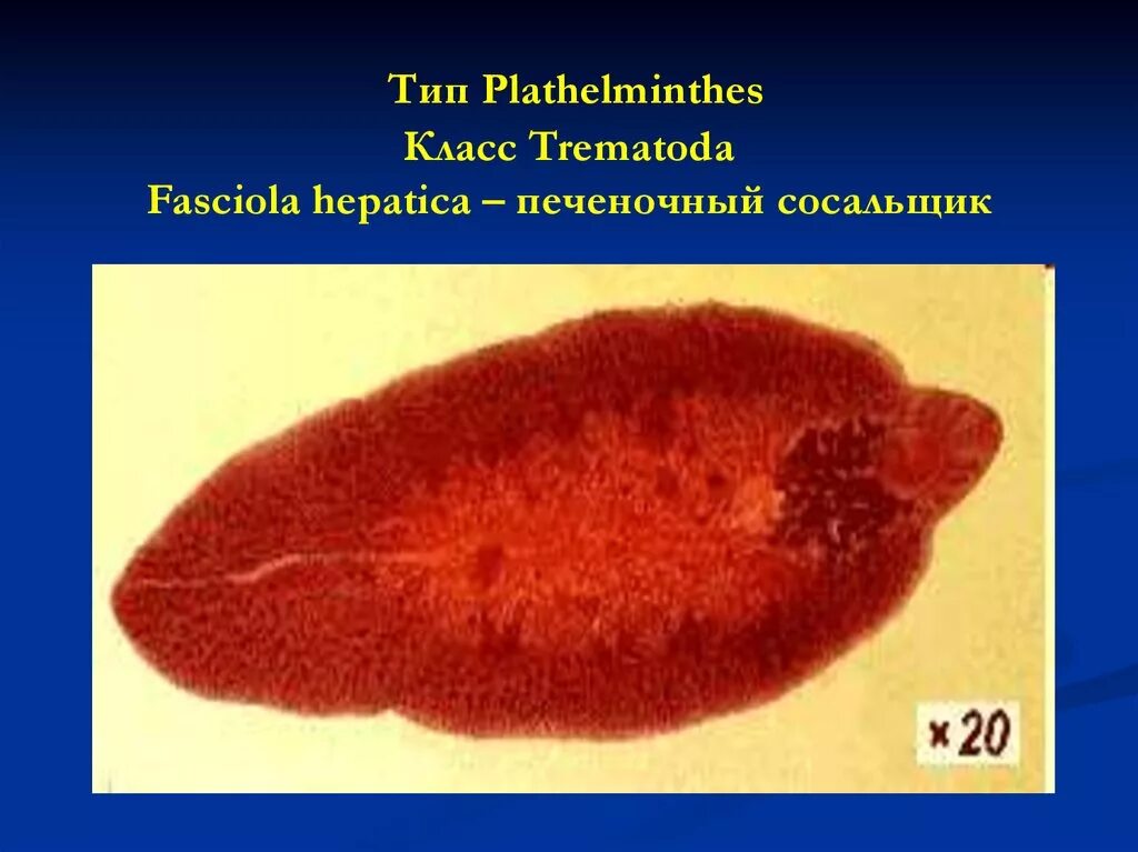 Fasciola hepatica яйца. Тип plathelminthes класс Trematoda. Трематоды Fasciola hepatica. Фасциола печеночная. Кишечный сосальщик
