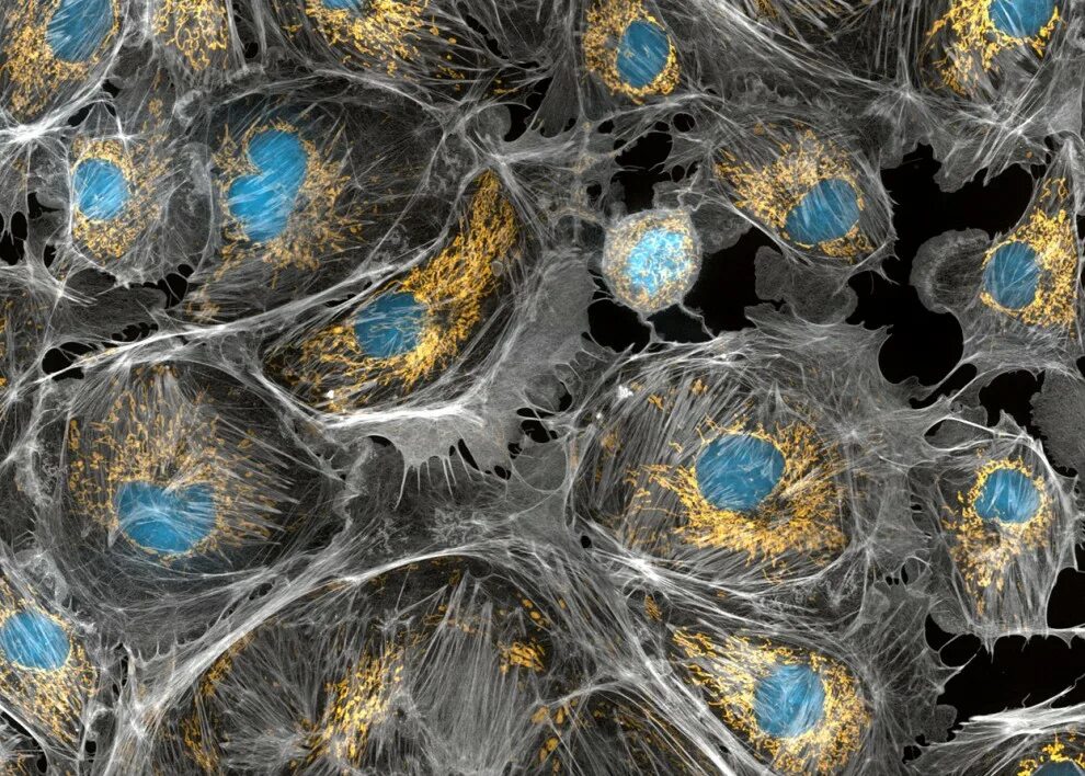 на данной микрофотографии представлены