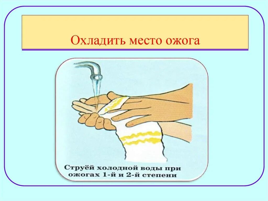 Получить ожог. Ожоги картинки для презентации.