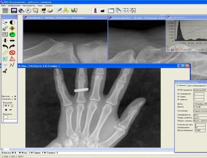 Золотое сечение рентгенодиагностические центры. Пикассо рентгенодиагностический центр. Рентгенодиагностические программы. Цифровой рентгенографический комплекс ICRCO Chrome LF 09/2017. Рентгенографический комплекс «Пардус-Нео».