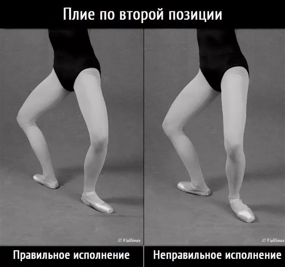 Тазобедренная выворотность