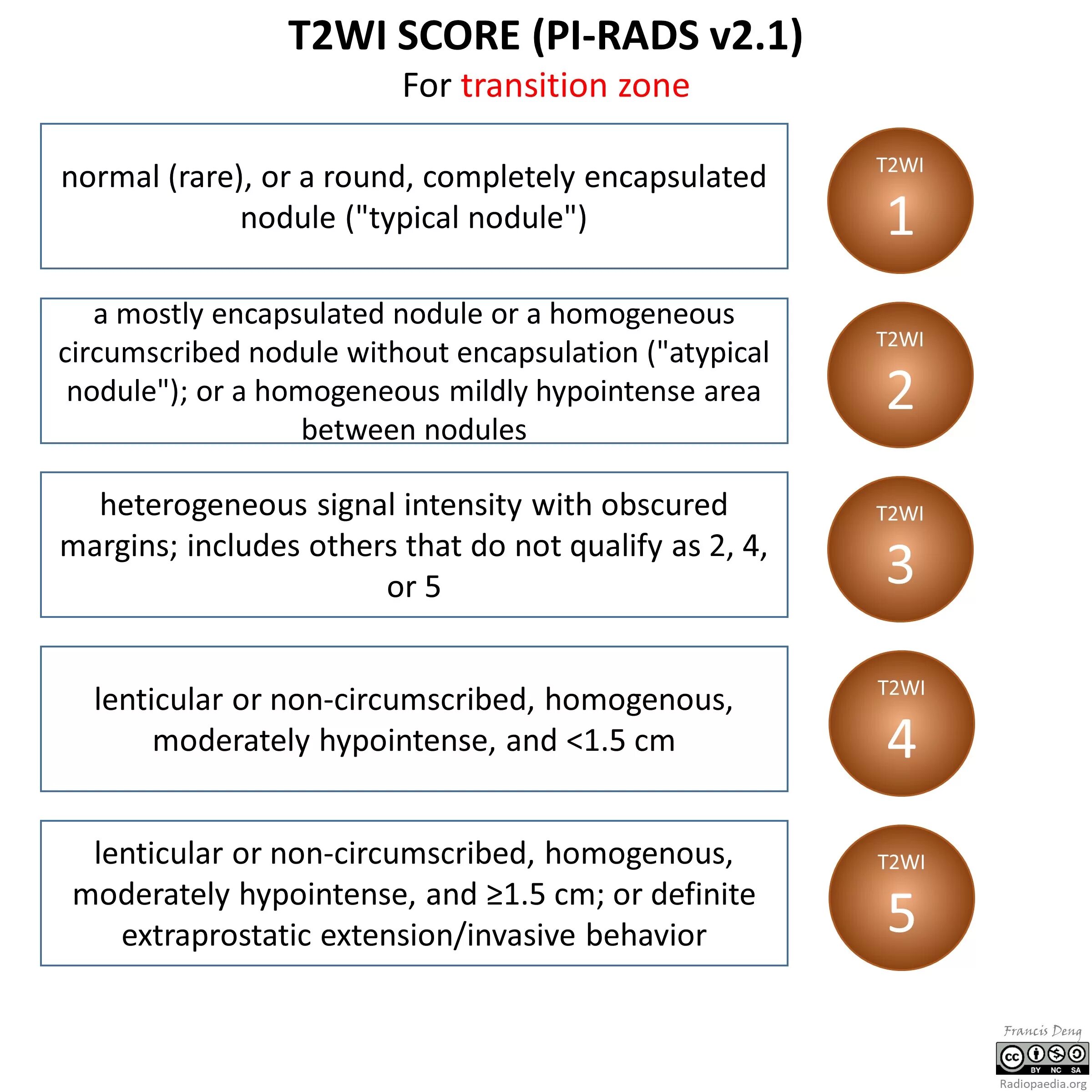 Pi rads 5. Pi-rads 2.1 классификация. Pi-rads 3-4. Pirads 2.1 зоны. IV категория Pi-rads.