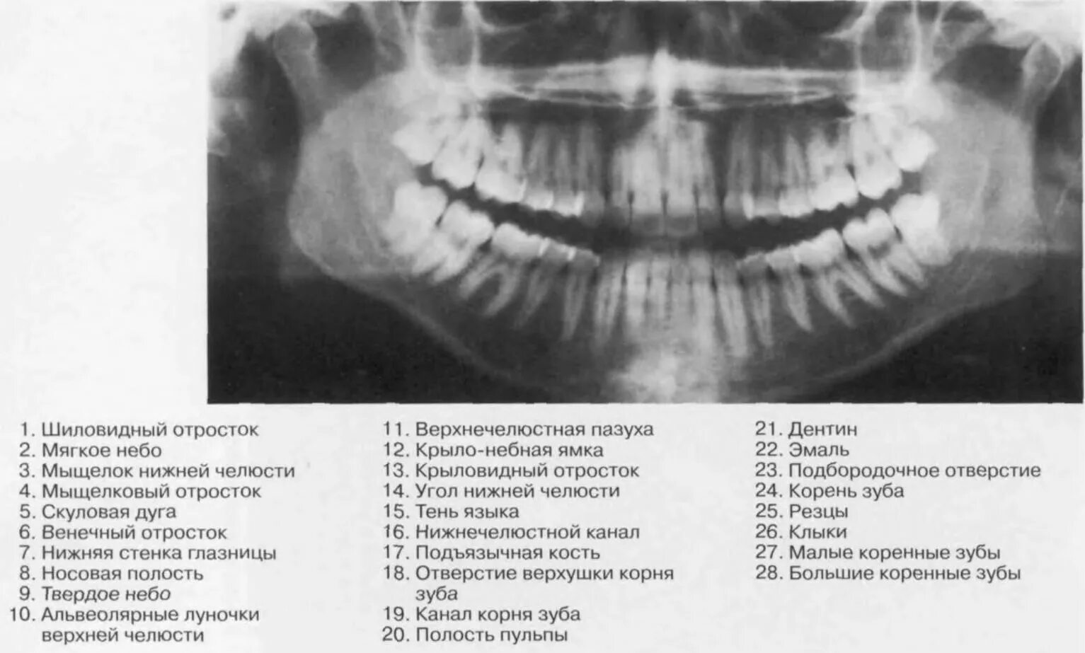 Мыщелкового отростка нижней челюсти. Мыщелковый отросток нижней челюсти рентген. Шиловидный отросток нижней челюсти. Венечный отросток нижней челюсти рентген.