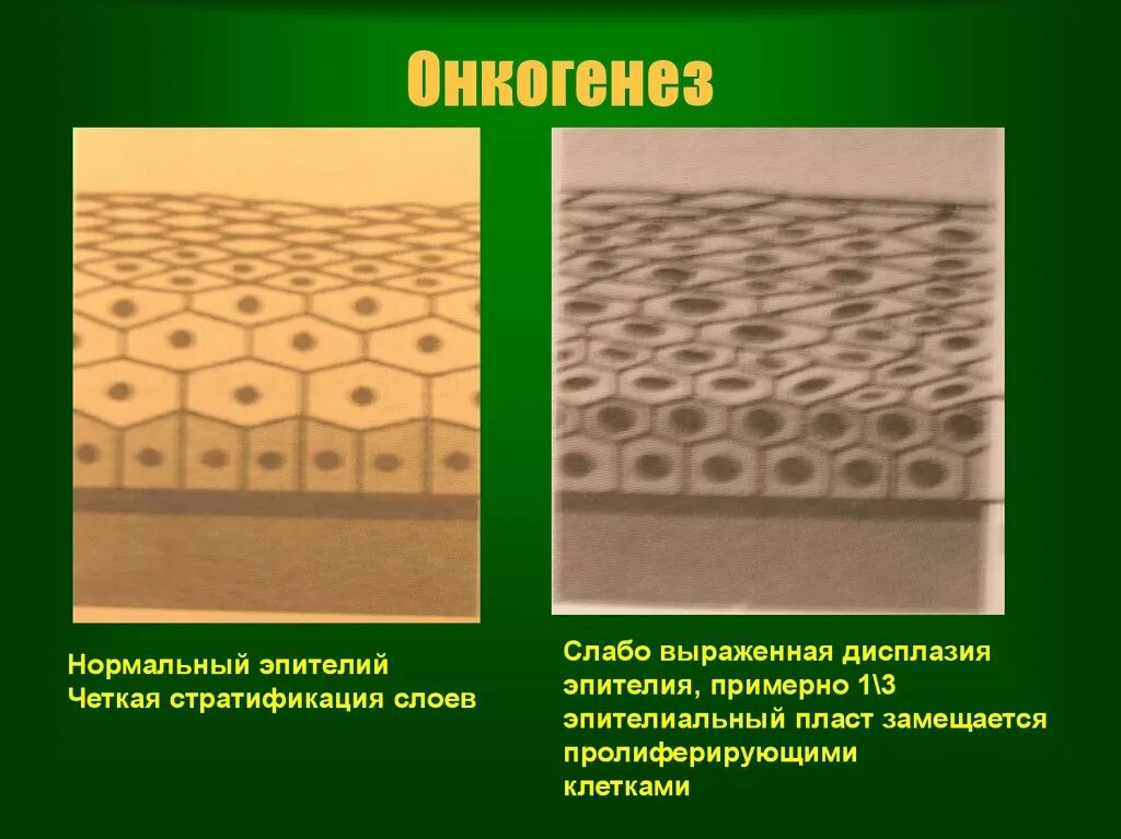 Онкогенез. Теломераза и онкогенез. Теломераза иммортализация. Теломераза иммортализация. Онкогенез.