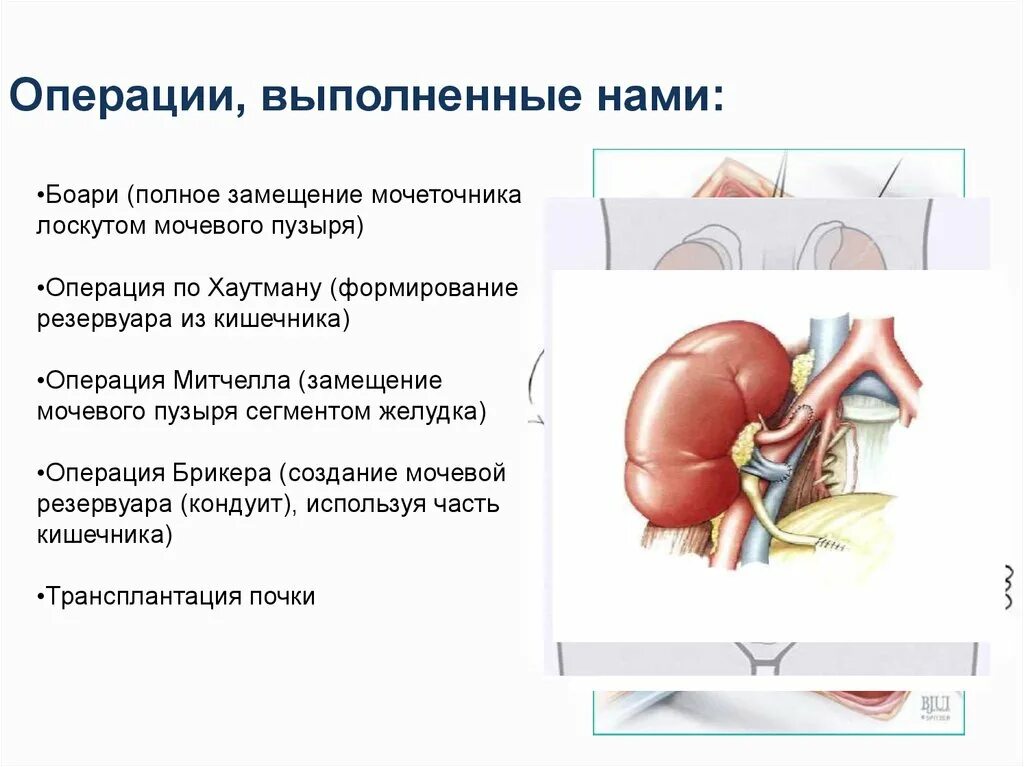 Которым были выполнены операции на