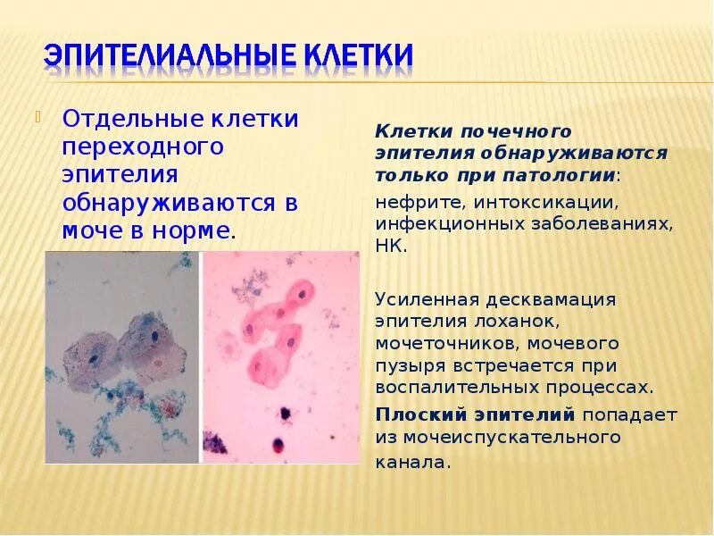 Нормы переходного эпителия в моче. Клетки почечного эпителия норма. Клетки эпителия в моче. Клетки переходного эпителия в моче. Повышенный эпителий в моче у мужчин