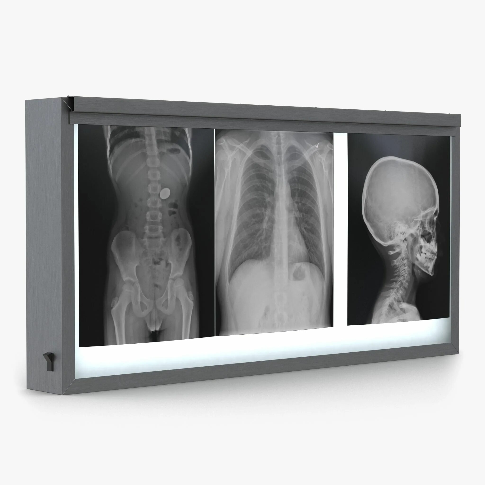 D a xray monolith. "X-ray Light Box" Control. 3d XRAY. 3d рентген компактный. Лайтбокс рентген.