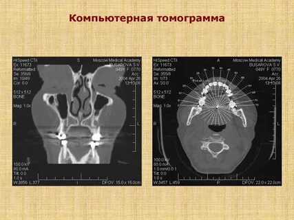 Кт 90