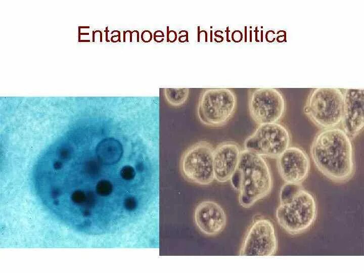 Цисты Entamoeba. Entamoeba coli заболевание. Entamoeba coli локализация. Entamoeba coli в кале