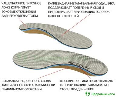 Сколиоз стельки