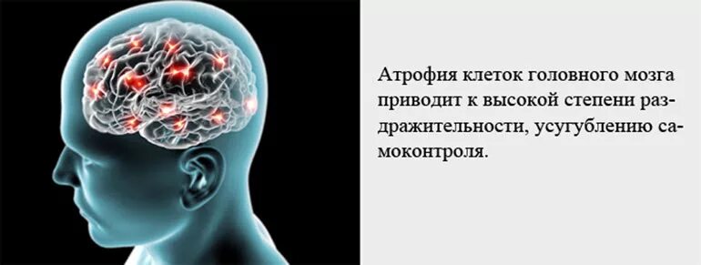 Атрофия головного мозга продолжительность. Отмирание клеток головного мозга. Атрофия клеток головного мозга.