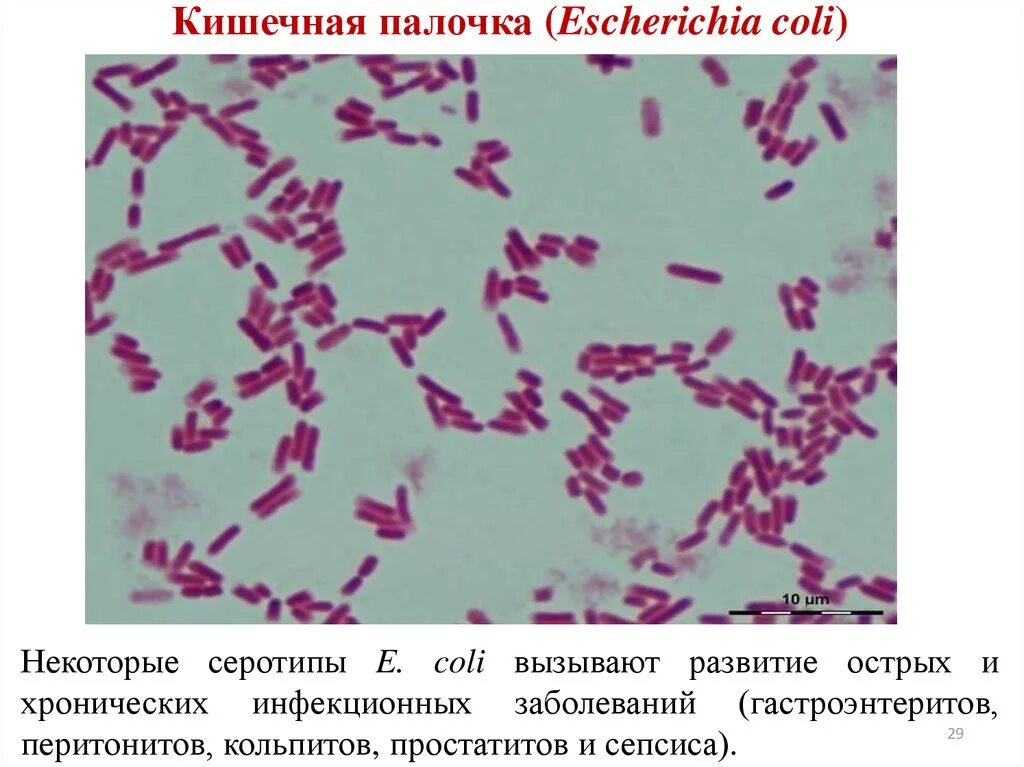 Свойства кишечной палочки. Кишечная палочка e.coli. Эшерихия коли микроскопия. Эшерихии кишечная палочка. Кишечная палочка грамотрицательная.